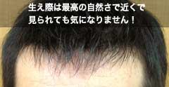 �ō��̎��R��