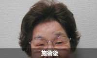 ��ި�����瑕����